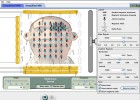 Simplified MRI | Recurso educativo 43727