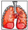 Enfermedades infiltrativas de los pulmones | Recurso educativo 76239