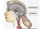 Síndromes de deficiencia poliglandular | Recurso educativo 80335